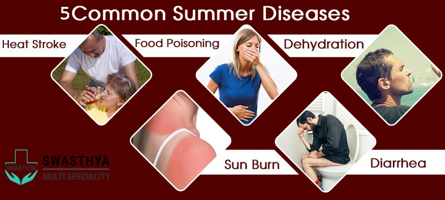 5 Common Summer Season Diseases