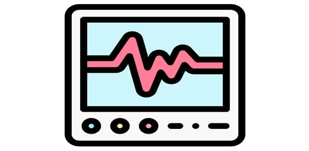 ECG